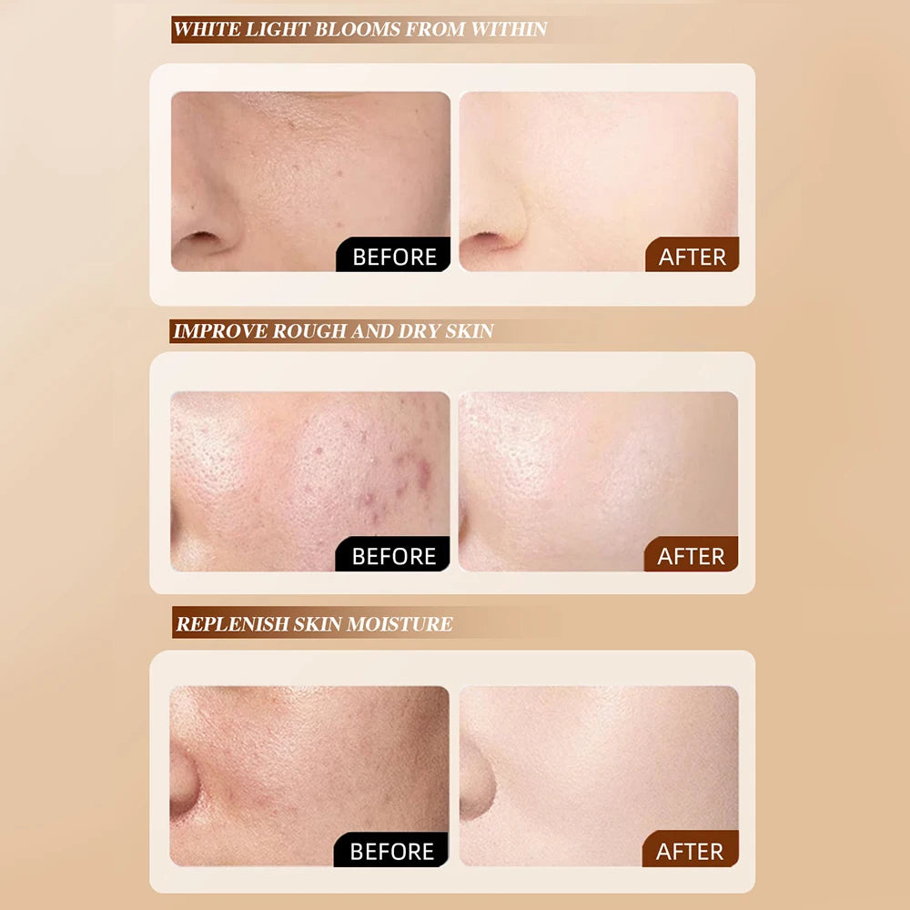 Mascarilla Facial Blemish Para Recuperar Brillo Natural En La Piel